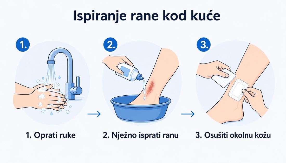 Tri koraka ispiranja rane kod kuće: pranje ruku, nježno ispiranje rane otopinom iz bočice nad posudom i sušenje okolne kože uz stavljanje čistog obloga.