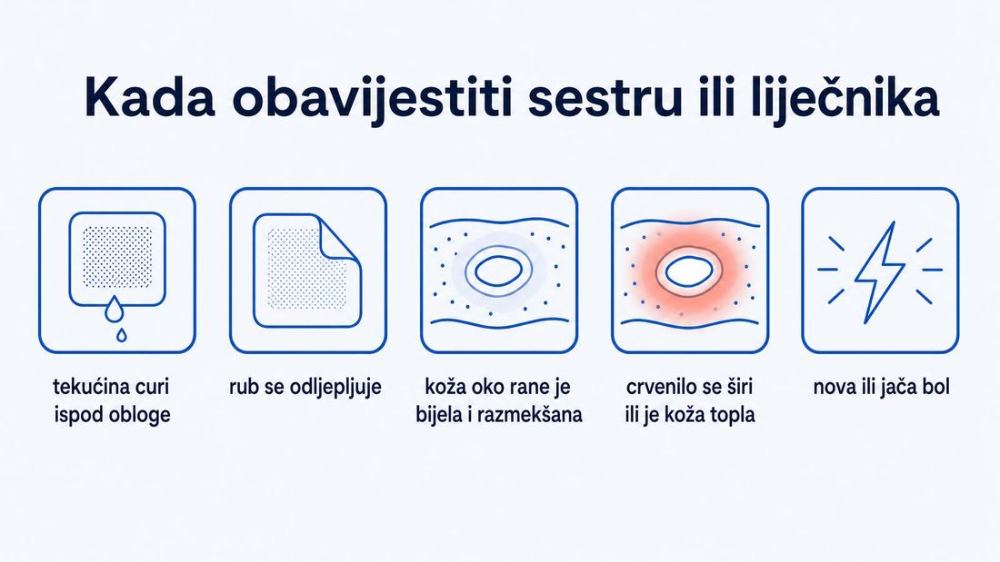 Prikaz situacija u kojima bolesnik treba obavijestiti medicinsku sestru ili liječnika