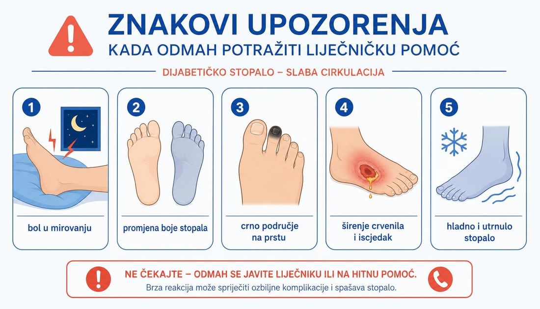 Pet znakova upozorenja kod stopala sa slabom cirkulacijom: bol u mirovanju, promjena boje stopala, crno područje na prstu, širenje crvenila s iscjedkom te hladno i utrnulo stopalo.