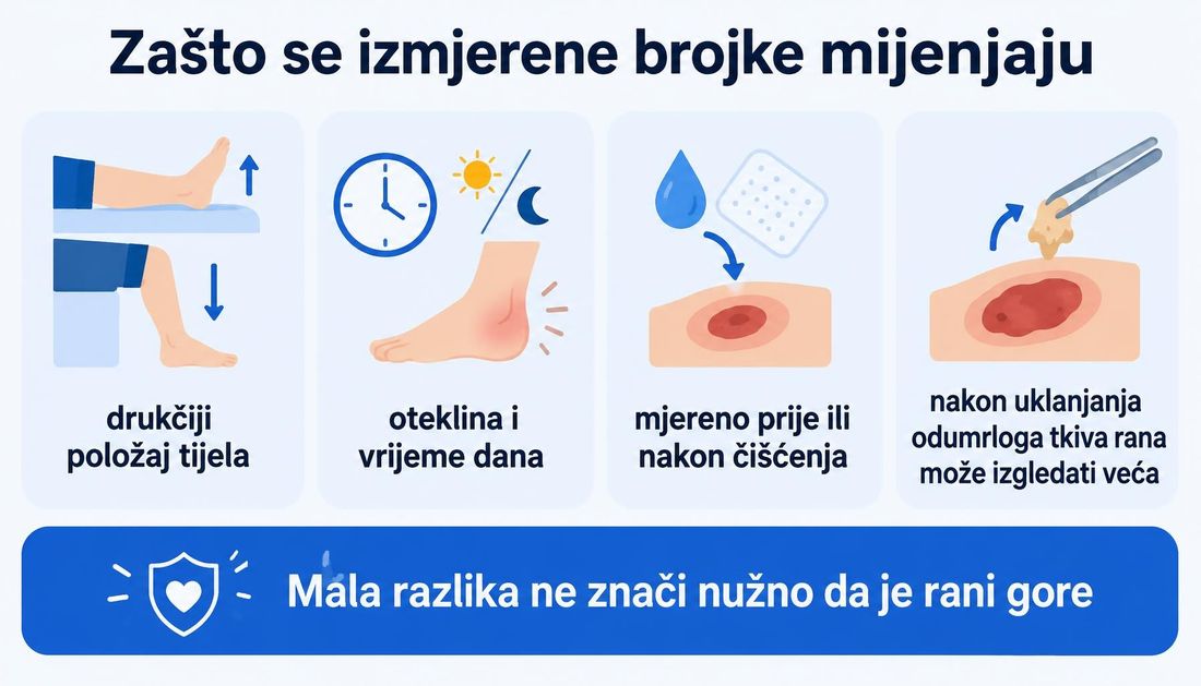 Jednostavna ilustracija za pacijente s četiri razloga zbog kojih se izmjerene brojke mijenjaju: drukčiji položaj tijela, oteklina i vrijeme dana, mjerenje prije ili nakon čišćenja te izgled rane nakon uklanjanja odumrloga tkiva.