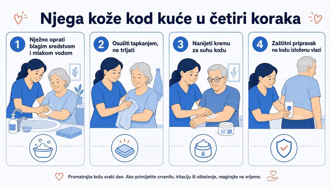 Jednostavna ilustracija za pacijente i obitelj: njega kože kod kuće u četiri koraka — nježno pranje blagim sredstvom, sušenje tapkanjem, krema za suhu kožu i zaštitni pripravak na kožu izloženu vlazi.