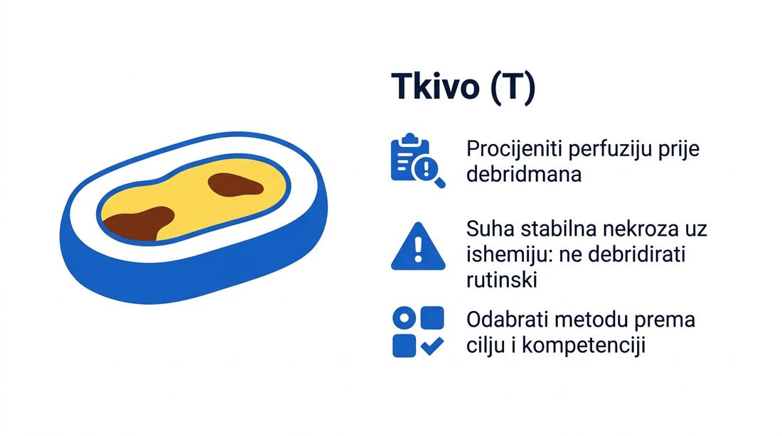Shema odluke o tkivu: prije debridmana procijeniti perfuziju, suhu stabilnu nekrozu uz ishemiju ne debridirati rutinski, metodu odabrati prema cilju i kompetenciji