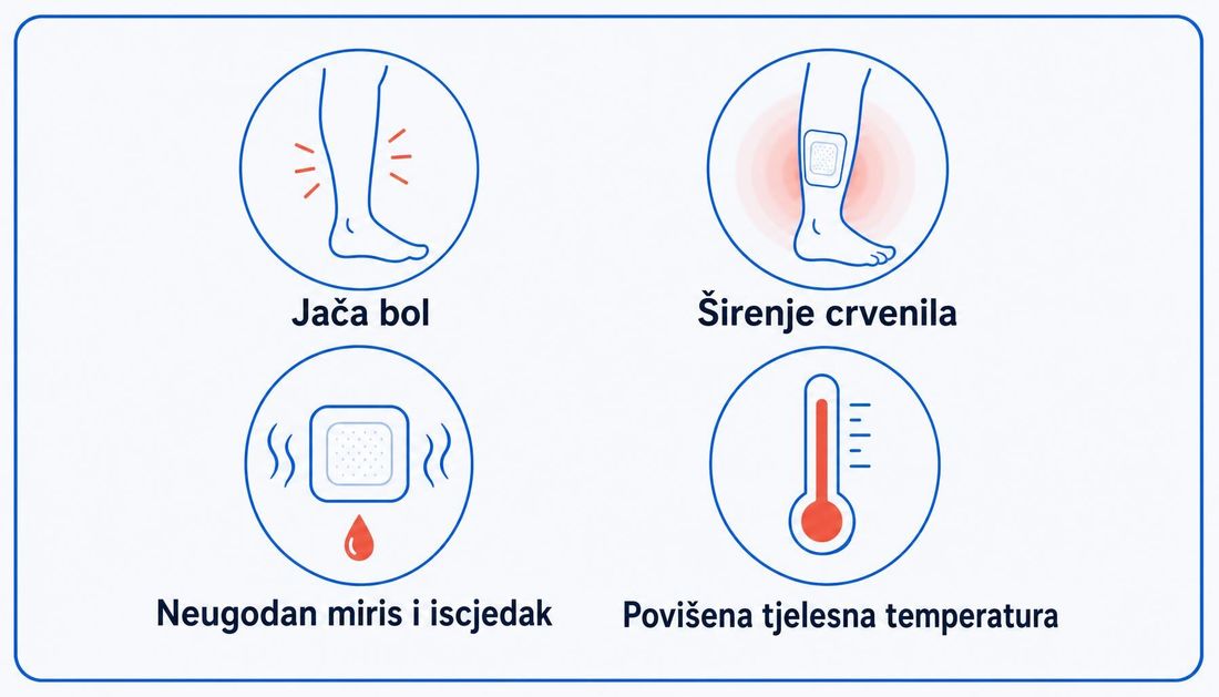 Jednostavna ilustracija četiriju znakova za javljanje zdravstvenom radniku: jača bol, širenje crvenila, neugodan miris i iscjedak te povišena tjelesna temperatura.