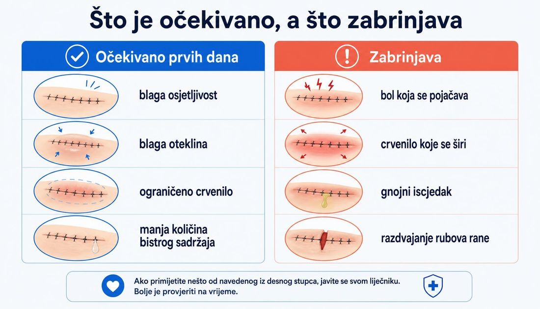 Pacijentska shema u dva stupca s hrvatskim oznakama: očekivane promjene prvih dana nakon operacije, poput blage osjetljivosti, blage otekline, ograničenoga crvenila i manje količine bistroga sadržaja, te zabrinjavajuće promjene, poput boli koja se pojačava, crvenila koje se širi, gnojnoga iscjetka i razdvajanja rubova rane.