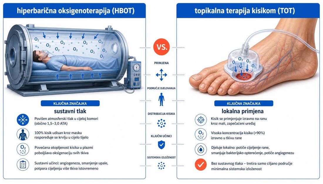 Usporedba hiperbarične oksigenoterapije u komori i topikalne terapije kisikom na stopalu, s razlikom sustavnog i lokalnog djelovanja.