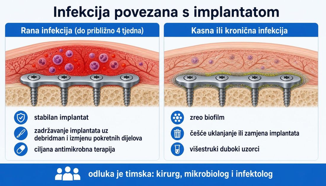 Usporedna shema infekcije povezane s implantatom s hrvatskim oznakama: rana infekcija do približno četiri tjedna sa stabilnim implantatom i zadržavanjem implantata uz debridman, nasuprot kasnoj ili kroničnoj infekciji sa zrelim biofilmom i češćim uklanjanjem ili zamjenom implantata.