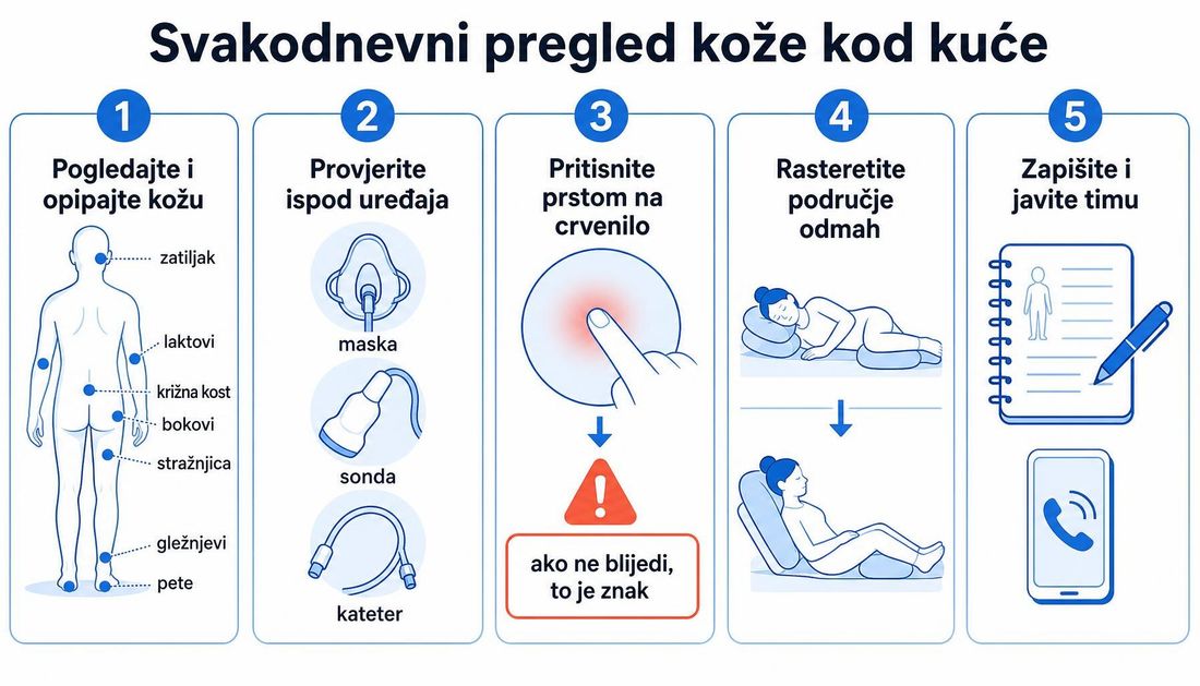 Shema svakodnevnog pregleda kože kod kuće u pet koraka: pogledati i opipati kožu na zatiljku, laktovima, križnoj kosti, bokovima, stražnjici, gležnjevima i petama, provjeriti kožu ispod maske, sonde i katetera, pritisnuti prstom na crvenilo, odmah rasteretiti područje i zapisati nalaz te javiti zdravstvenom timu.
