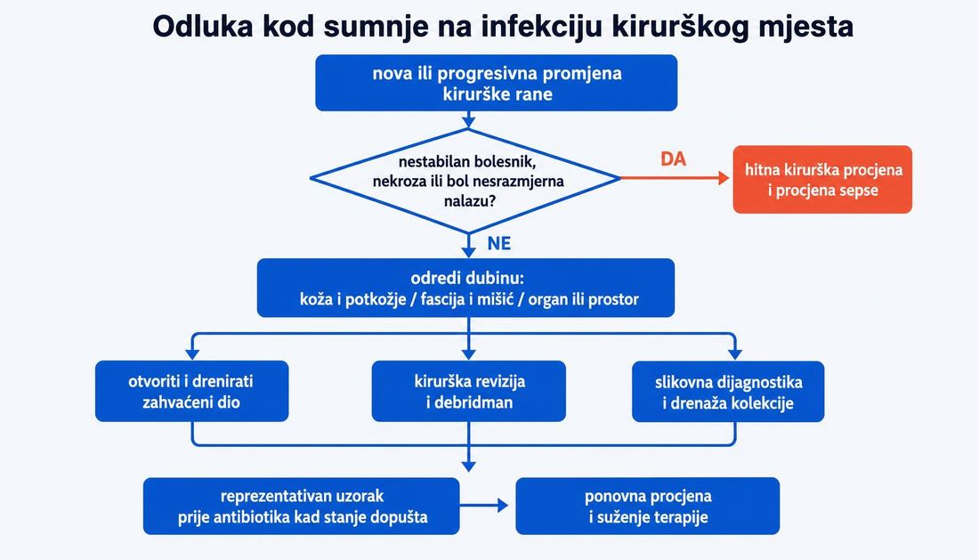 Dijagram odluke kod sumnje na infekciju kirurškog mjesta s hrvatskim oznakama: nova ili progresivna promjena rane, provjera nestabilnosti i boli nesrazmjerne nalazu, određivanje dubine, drenaža, kirurška revizija ili slikovna dijagnostika te uzorkovanje i ponovna procjena terapije.