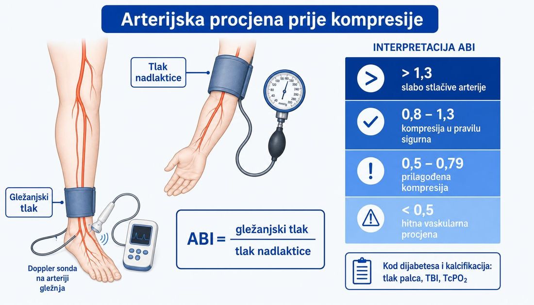 Shema mjerenja gležanjsko-nadlaktičnog indeksa: manžeta na gležnju s Doppler sondom i manžeta na nadlaktici, formula ABI, ljestvica interpretacije vrijednosti te napomena o mjerenju tlaka palca kod dijabetesa i kalcifikacija.