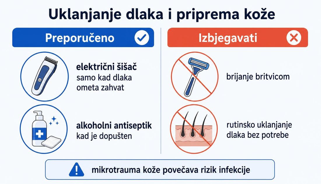 Usporedna shema pripreme kože s hrvatskim oznakama: preporučeni električni šišač samo kada dlaka ometa zahvat i alkoholni antiseptik kada je dopušten, nasuprot brijanju britvicom i rutinskom uklanjanju dlaka koje treba izbjegavati.