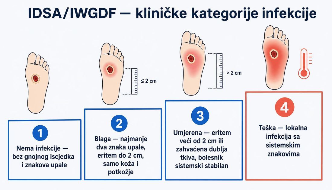 Četiri kategorije infekcije prema IDSA/IWGDF prikazane kao rastuće stepenice, s eritemom do i iznad 2 cm te sistemskim znakovima.