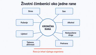 Shema s kroničnom ranom u središtu i osam povezanih čimbenika oko nje: stres, san, pušenje, alkohol, lijekovi, nedopuštene droge, tjelesna aktivnost i prehrana.