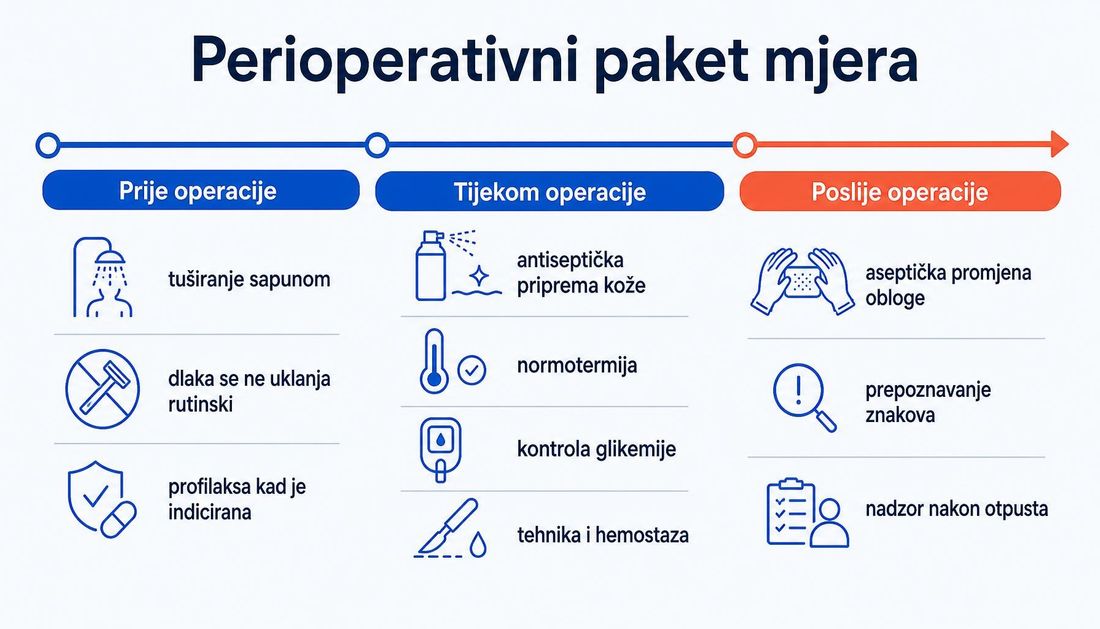 Vremenska os perioperativnoga paketa mjera s hrvatskim oznakama: prije operacije tuširanje sapunom, dlaka se ne uklanja rutinski i profilaksa kad je indicirana; tijekom operacije antiseptička priprema kože, normotermija, kontrola glikemije te tehnika i hemostaza; poslije operacije aseptička promjena obloge, prepoznavanje znakova i nadzor nakon otpusta.