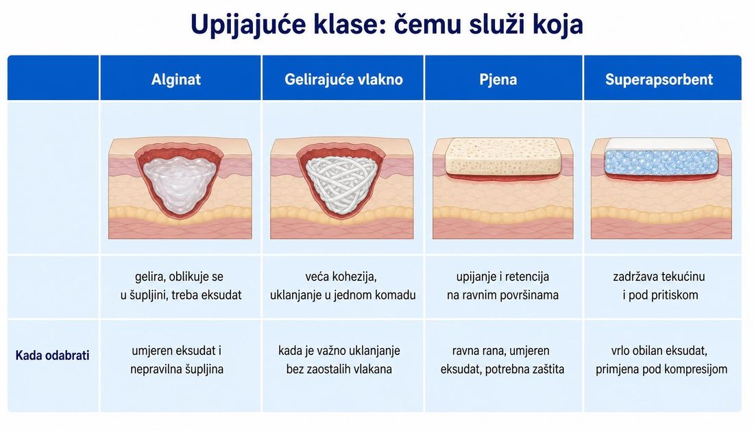 Usporedna tablica upijajućih klasa: alginat, gelirajuće vlakno, pjena i superapsorbent