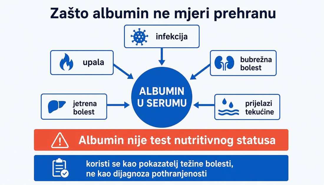 Shema u kojoj strelice od upale, infekcije, bubrežne bolesti, jetrene bolesti i prijelaza tekućine pokazuju na albumin u serumu, s napomenom da albumin nije test nutritivnog statusa nego pokazatelj težine bolesti.