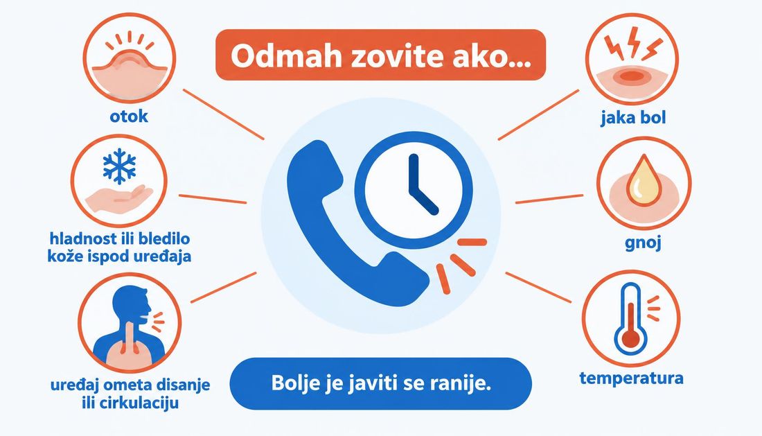 Jednostavna pacijentska shema znakova za javljanje timu: hladan, bjed ili plav ekstremitet ispod gipsa, jaka bol, širenje crvenila, gnoj, vrućica i oteklina.