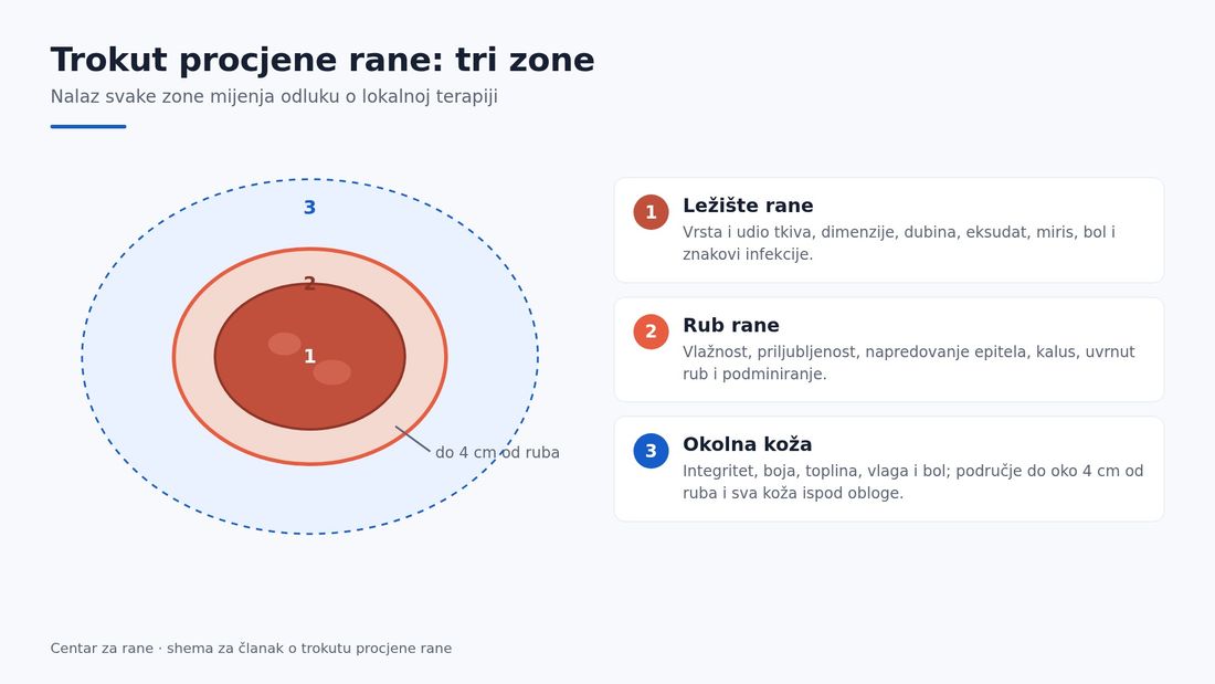 Shema rane s tri označene zone: središnje ležište rane, prstenasti rub rane i šire područje okolne kože do četiri centimetra od ruba, sa sažetkom onoga što se procjenjuje u svakoj zoni.