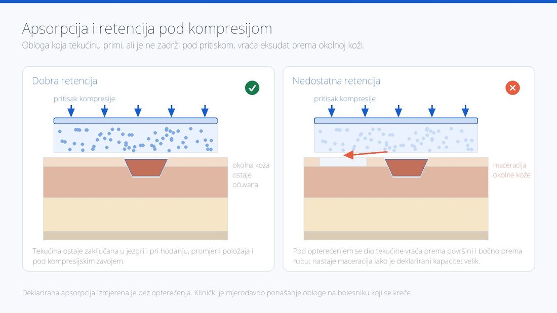 Usporedba obloge s dobrom i s nedostatnom retencijom pod kompresijom te posljedična maceracija okolne kože