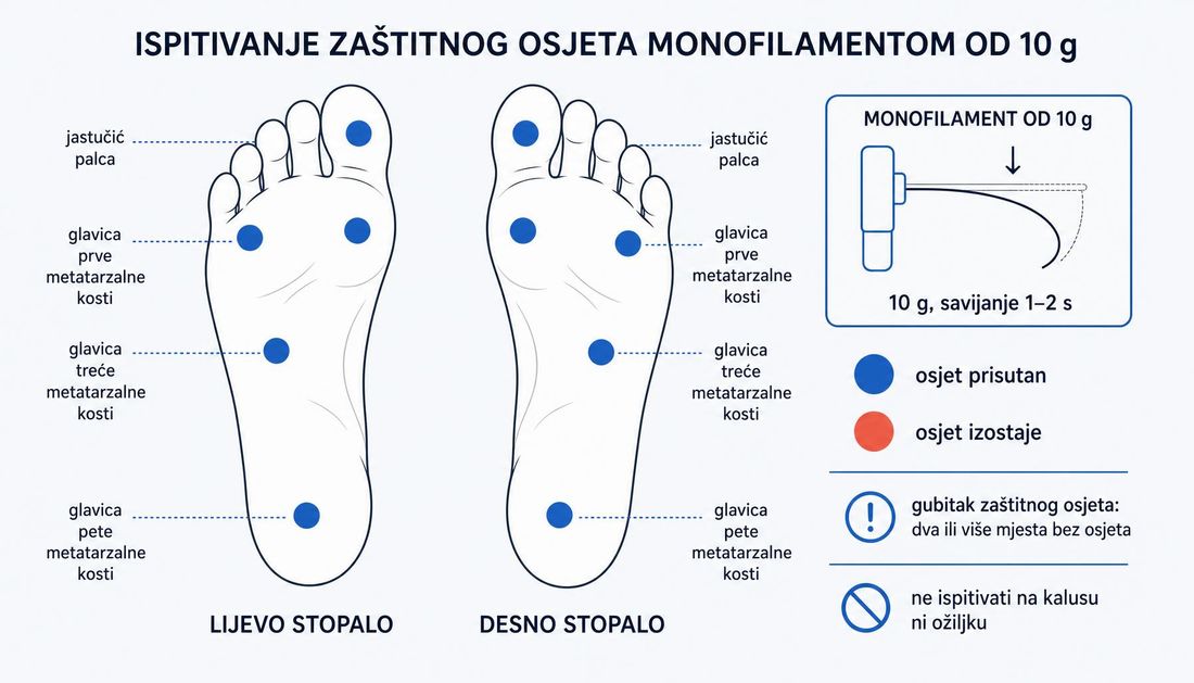 Tabani lijevog i desnog stopala s označenim mjestima ispitivanja monofilamentom od 10 g: jastučić palca i glavice prve, treće i pete metatarzalne kosti, uz prikaz savijanja monofilamenta i napomenu da se ne ispituje na kalusu ni ožiljku.