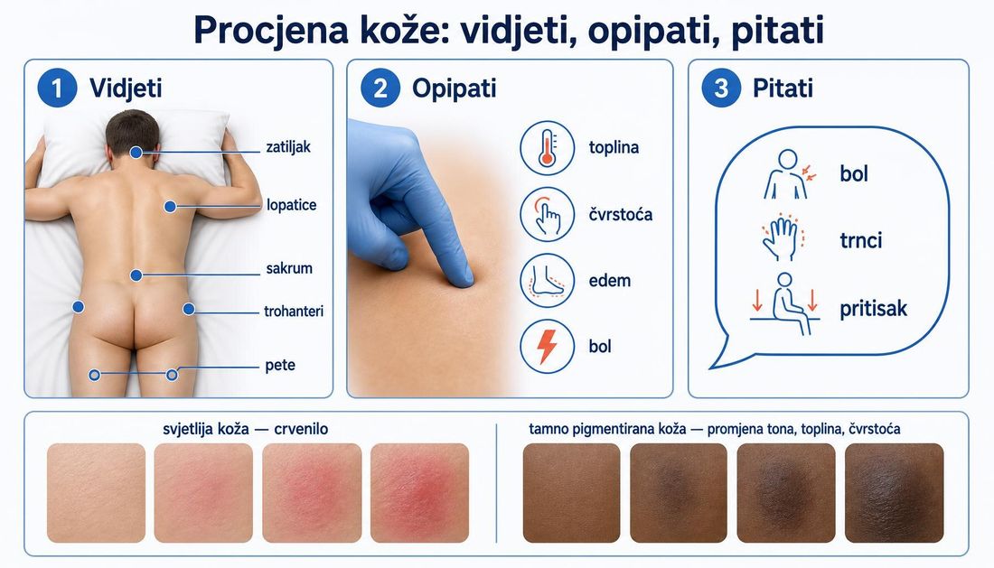 Shema procjene kože u tri koraka: vidjeti rizična mjesta (zatiljak, lopatice, križna kost, trohanteri, pete), opipati toplinu, čvrstoću, edem i bol te pitati bolesnika, uz usporedbu svjetlije i tamno pigmentirane kože.