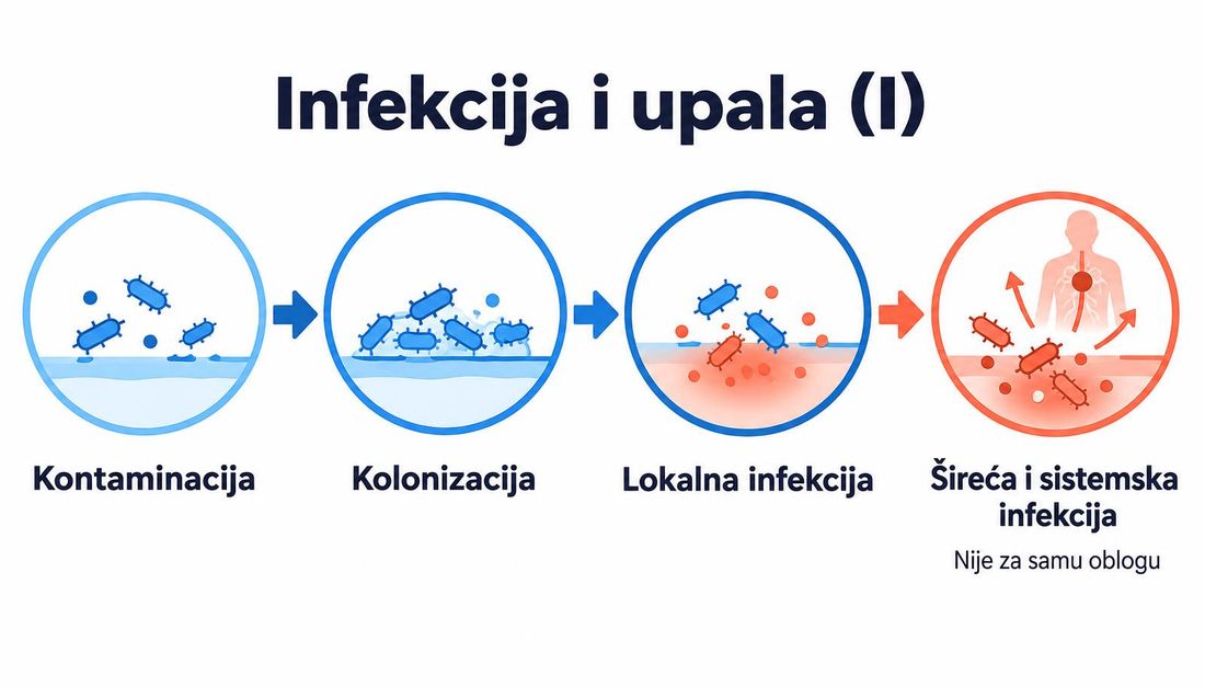 Shema kontinuuma mikroorganizama u rani: kontaminacija, kolonizacija, lokalna infekcija te šireća i sistemska infekcija koja se ne liječi samom oblogom