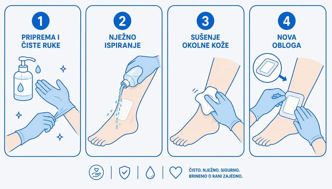 Jednostavna ilustracija u četiri koraka za pacijente: priprema i čiste ruke, nježno ispiranje rane, sušenje okolne kože i stavljanje nove obloge.