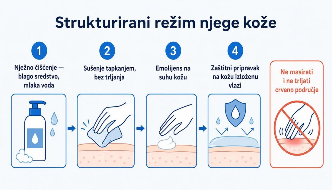 Shema strukturiranog režima njege kože u četiri koraka: nježno čišćenje blagim sredstvom, sušenje tapkanjem, emolijens na suhu kožu i zaštitni pripravak na kožu izloženu vlazi, s napomenom da se crveno područje ne masira i ne trlja.