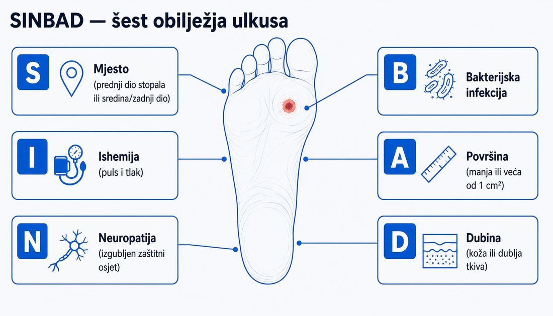 Shema stopala s ulkusom i šest sastavnica SINBAD-a: mjesto, ishemija, neuropatija, bakterijska infekcija, površina i dubina.