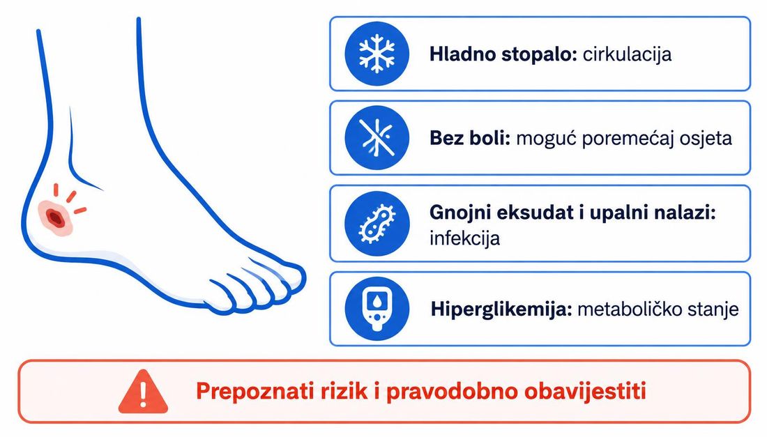 Shema scenarija rane stopala: hladno stopalo upućuje na cirkulaciju, izostanak boli na poremećaj osjeta, gnojni eksudat na infekciju, hiperglikemija na metaboličko stanje