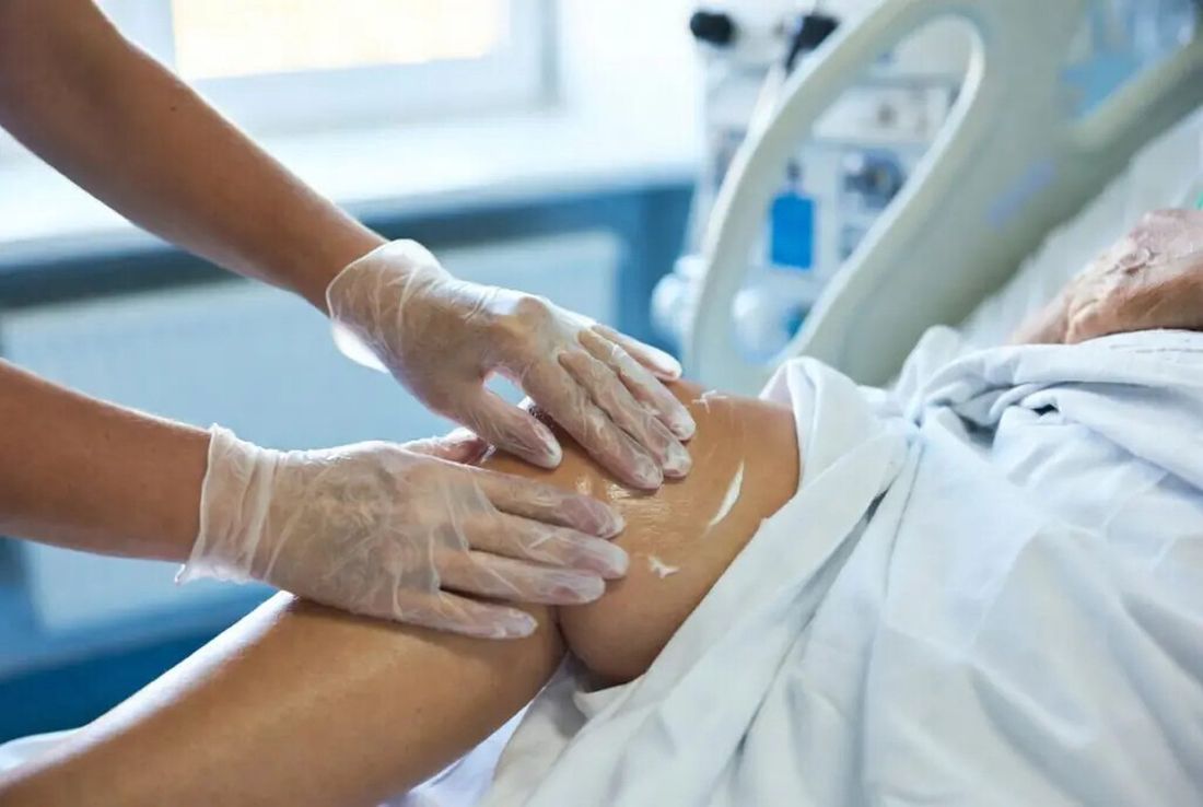 Zdravstveni djelatnik pregledava kožu nepokretnog bolesnika i primjenjuje nježnu zaštitnu njegu radi prevencije dekubitusa.