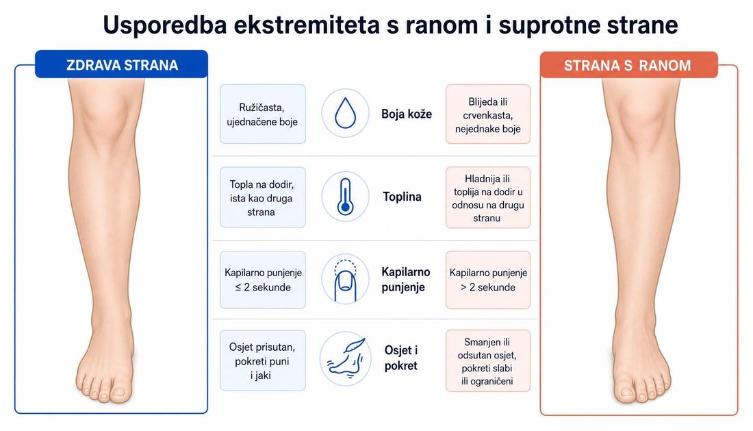 Usporedni prikaz dvije potkoljenice i stopala: zdrava strana s ujednačenom bojom, toplinom, kapilarnim punjenjem do dvije sekunde i očuvanim osjetom te strana s ranom s blijedom ili crvenkastom kožom, promijenjenom toplinom, dužim kapilarnim punjenjem i smanjenim osjetom.