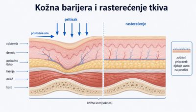 Presjek kože i mekih tkiva iznad križne kosti: lijevo pritisak i posmična sila deformiraju dublja tkiva, desno je područje rasterećeno, uz napomenu da zaštitni pripravak djeluje samo na površini kože.