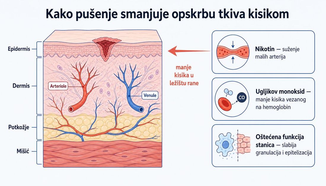 Presjek kože s epidermisom, dermisom, potkožjem i mišićem, površinskom ranom, arteriolom i venulom te tri mehanizma pušenja: suženje malih arterija, vezanje ugljikova monoksida na hemoglobin i oštećena funkcija stanica.