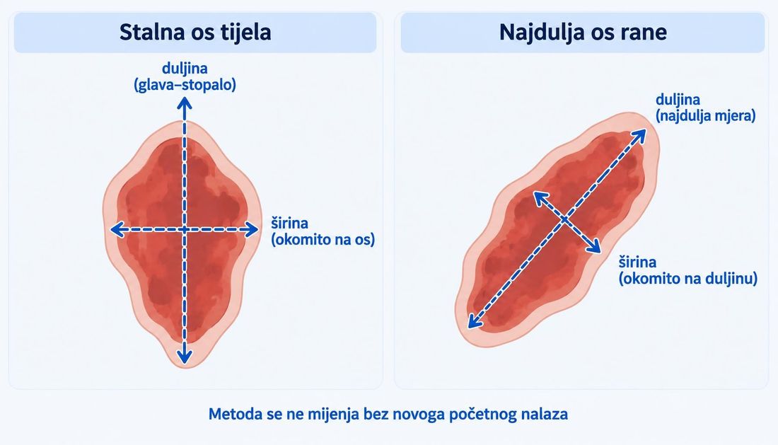 Shema s dva panela: ista nepravilna rana mjerena prema stalnoj osi tijela glava–stopalo i prema najduljoj osi rane, sa strelicama za duljinu i širinu okomitu na duljinu.