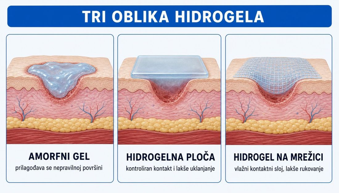 Anatomski presjeci kože s tri oblika hidrogela: amorfni gel koji ispunjava nepravilnu površinu, hidrogelna ploča iznad ležišta rane i hidrogel na mrežici kao vlažni kontaktni sloj.