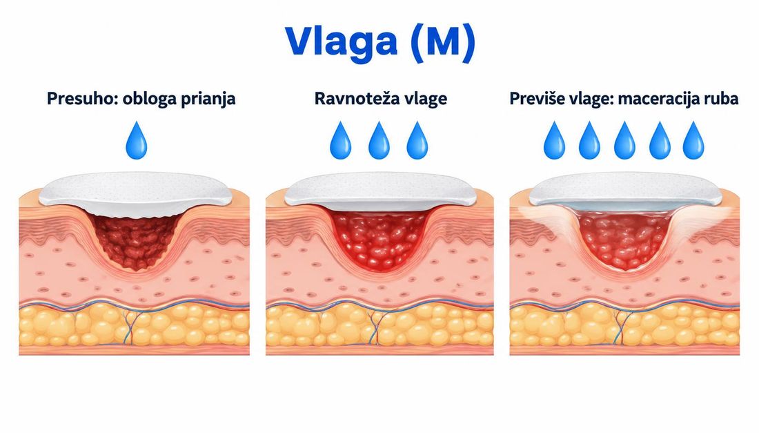 Tri presjeka kože s ranom i oblogom: presuho ležište uz prianjanje obloge, ravnoteža vlage te višak vlage s maceracijom ruba