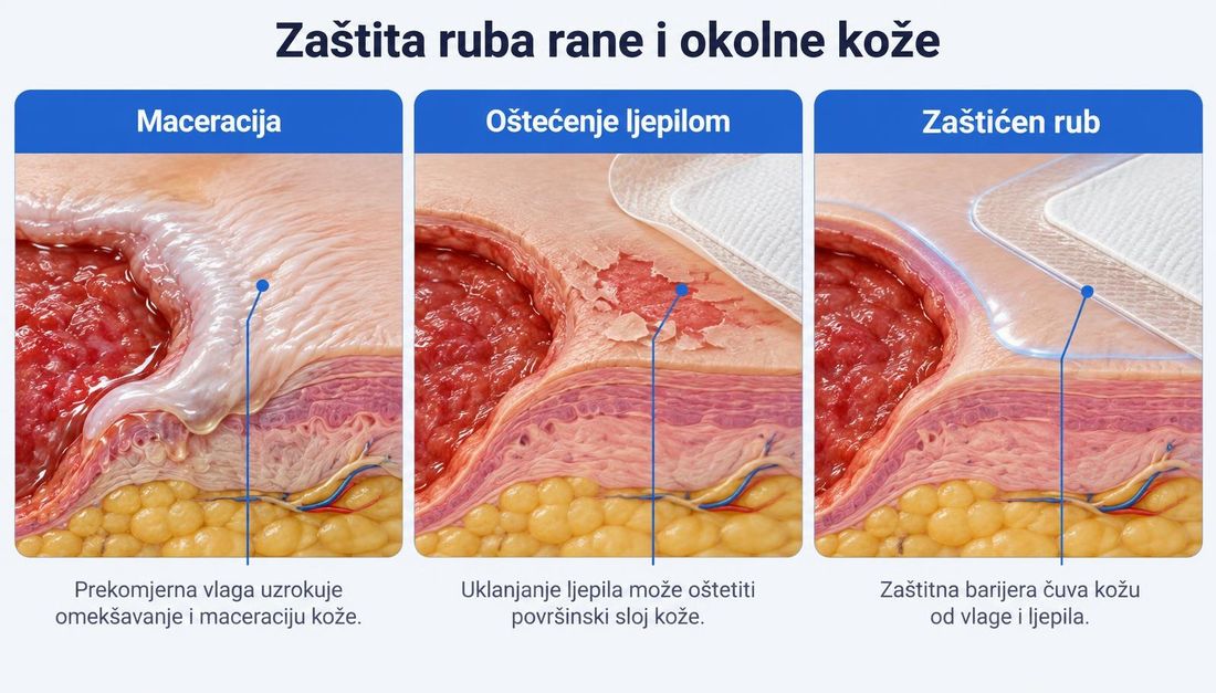 Tri klinička presjeka ruba rane: maceracija s omekšanom i naboranom kožom, oštećenje površinskog sloja kože nakon uklanjanja ljepila i zaštićen rub s tankim barijernim slojem ispod šireg ruba obloge.