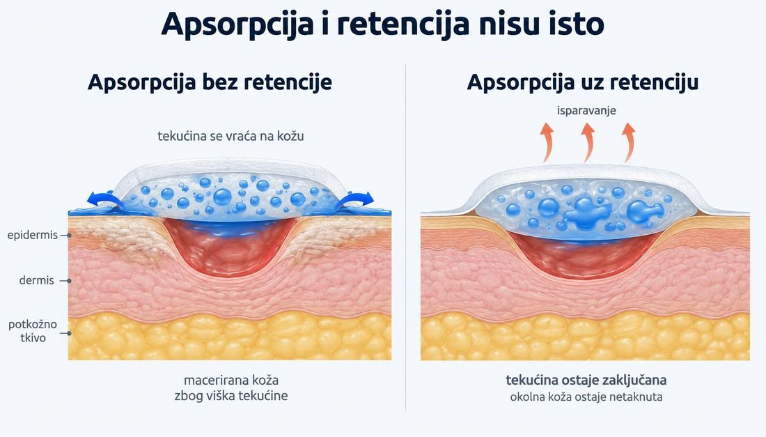 Usporedni presjek kože i potkožnog tkiva s dvije obloge: lijevo obloga koja upija ali ne zadržava tekućinu, pa se tekućina vraća na okolnu kožu i macerira je, desno obloga koja tekućinu zadržava u jezgri, uz isparavanje kroz površinu i netaknutu okolnu kožu.