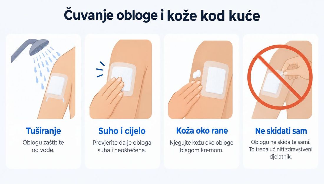 Četiri pacijentska prikaza brige o oblozi kod kuće: zaštita obloge pri tuširanju, provjera je li obloga suha i neoštećena, njega kože oko obloge blagom kremom i uputa da se obloga ne skida samostalno.