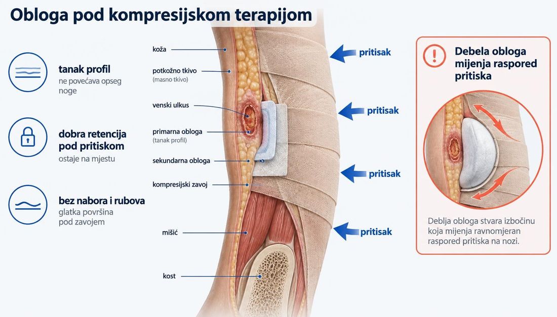 Presjek potkoljenice s venskim ulkusom, tankom primarnom oblogom, sekundarnom oblogom i slojevima kompresijskog zavoja, sa strelicama pritiska prema unutra i napomenom da debela obloga mijenja raspored pritiska.