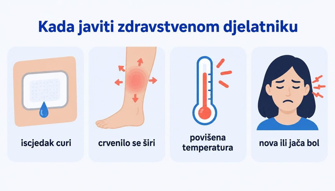 Četiri pacijentska prikaza znakova za javljanje: iscjedak koji curi ispod obloge, crvenilo koje se širi po potkoljenici, povišena tjelesna temperatura i nova ili jača bol.