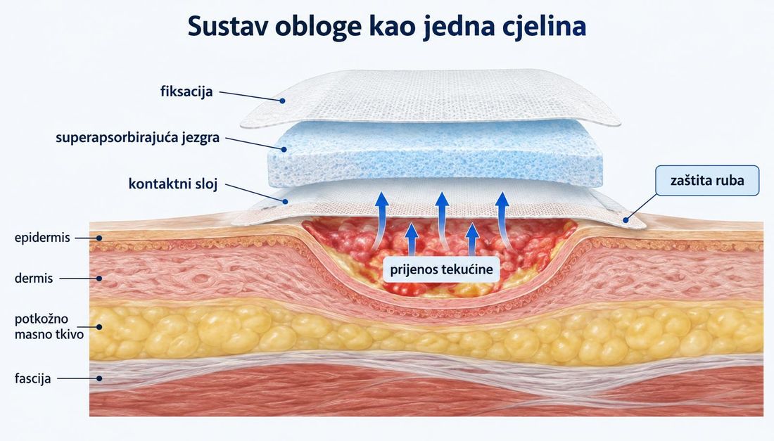Presjek kože s plitkom ranom i tri odvojena sloja obloge nad njom: kontaktni sloj, superapsorbirajuća jezgra i fiksacija, sa strelicama prijenosa tekućine iz ležišta prema jezgri i napomenom o zaštiti ruba.